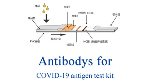 COVID-19ため抗体抗原テスト